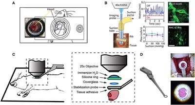 Intravital Microscopy of the Beating Murine Heart to Understand Cardiac Leukocyte Dynamics